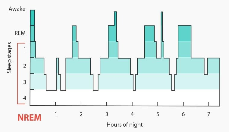 하룻밤 수면 단계 그래프. 세로축 Sleep stages 는 위에서부터 Awake, REM, 1, 2, 3, 4 이고 1~4 구간이 NREM 으로 묶여 있다. 가로축은 Hours of night 1부터 7까지