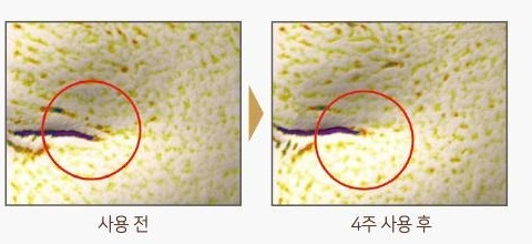 눈가 피부 표면을 촬영한 사진 두 장. 사용 전과 4주 사용 후, 빨간 원으로 주름 부위 표시