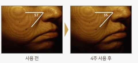 뺨 피부를 등고선으로 촬영한 사진 두 장. 사용 전 각도 표시 57, 4주 사용 후 각도 표시 55