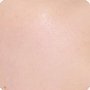 사용 전 — 뺨 피부를 가까이 찍은 사진. 붉은 기와 작은 잡티가 보인다