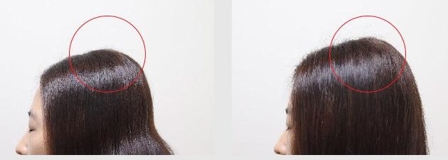 정수리 볼륨 막대그래프: 사용 전 1946.364에서 사용 직후 2030.000으로 4.297% 증가