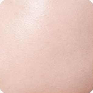 사용 후 — 같은 뺨 피부. 주근깨와 잡티가 가려져 고르게 보인다